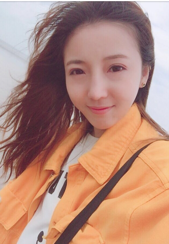 鄭州致美士整形醫(yī)院醫(yī)生閆江濤做鼻綜合+自體脂肪填充+吸脂案例效果對比圖