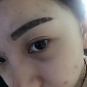 大同清木整形醫(yī)院張樹(shù)霞醫(yī)生做半永久紋眉效果如何？附半永久紋眉效果圖