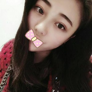 張家口維多利亞整形醫(yī)院張凱醫(yī)生做全切雙眼皮真實案例效果對比圖