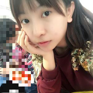 大同清木整形醫(yī)院張樹(shù)霞醫(yī)生做半永久紋眉效果如何？附半永久紋眉效果圖