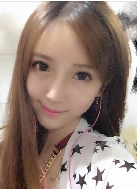 鄭州致美士整形醫(yī)院醫(yī)生閆江濤做鼻綜合+自體脂肪填充+吸脂案例效果對比圖