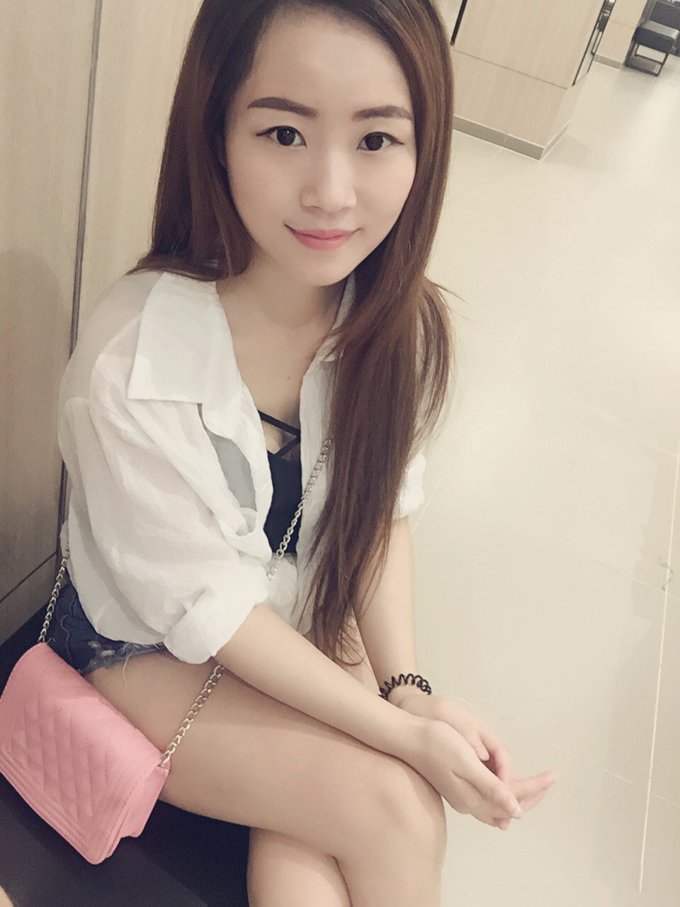 廣東韓妃醫(yī)療美容醫(yī)院做切開雙眼怎么樣？附案例效果圖