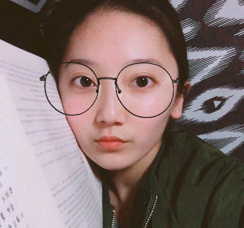 深圳鵬愛醫(yī)療美容醫(yī)院醫(yī)生文炯軫做埋線隆鼻怎么樣？附案例