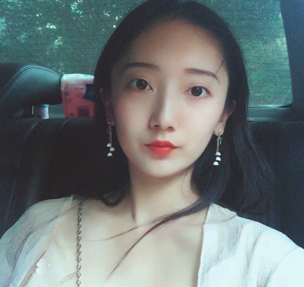 深圳鵬愛醫(yī)療美容醫(yī)院醫(yī)生文炯軫做埋線隆鼻怎么樣？附案例