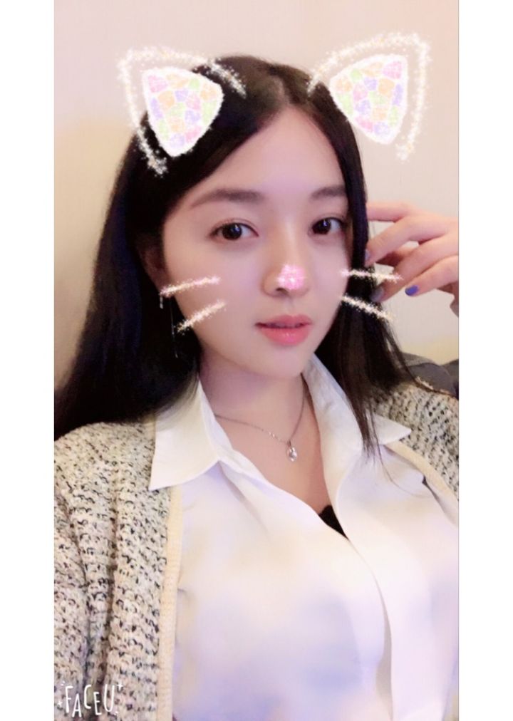 北京京韓整形醫(yī)生王義山做埋線雙眼皮怎么樣？附案例效果對比圖