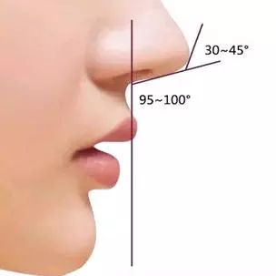 烏魯木齊黎美整形軟骨隆鼻