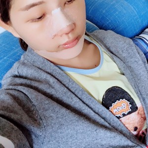 北京京民醫(yī)院整形外科醫(yī)生李鴻儒做硅膠隆鼻怎么樣？附案例效果圖