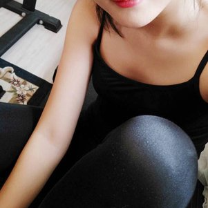 岳陽愛思特醫(yī)療美容醫(yī)院醫(yī)生王福生做手臂吸脂怎么樣？附案例效果圖