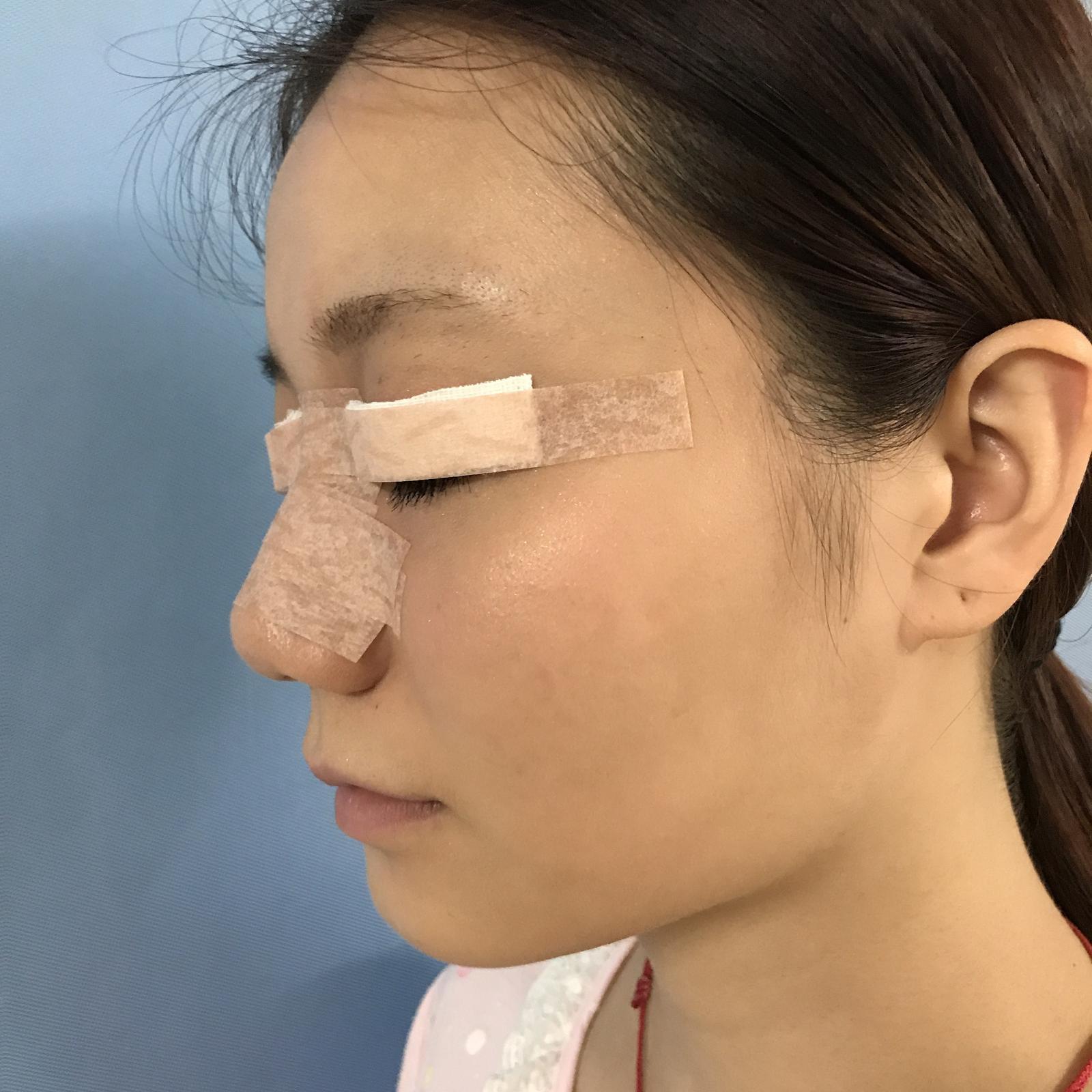 武漢華美整形醫(yī)院醫(yī)生王向陽(yáng)做眼綜合整形怎么樣？附案例效果圖