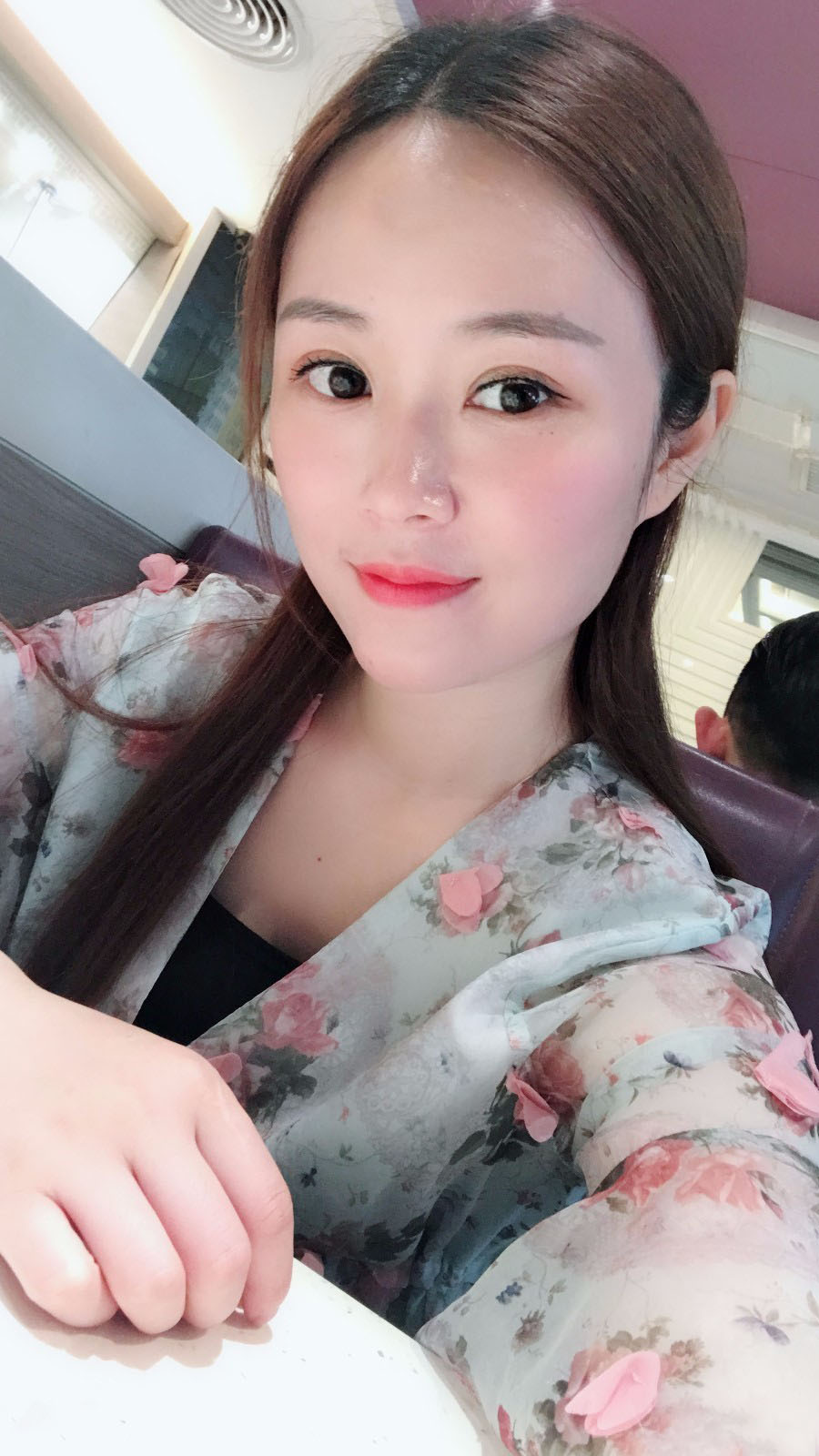 廣東韓妃醫(yī)療美容醫(yī)院做切開雙眼怎么樣？附案例效果圖