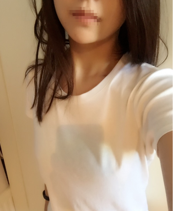 東莞韓美整形醫(yī)院醫(yī)生黃玉潔做假體隆胸怎么樣？附案例效果圖