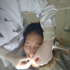 洛陽(yáng)友好口腔醫(yī)院醫(yī)生李新然做牙貼面怎么樣？附案例效果圖