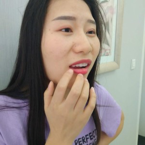 洛陽(yáng)友好口腔醫(yī)院醫(yī)生李新然做牙貼面怎么樣？附案例效果圖