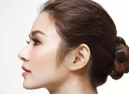 永州星雅整形鼻小柱延長