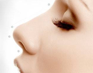 益陽(yáng)韓美整形耳軟骨墊鼻尖