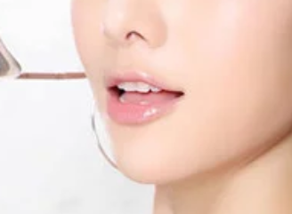 鄭州致美士整形醫(yī)院假體隆下巴