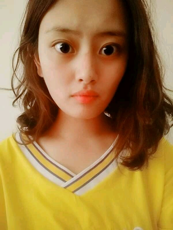 廣州愛來整形醫(yī)院醫(yī)生肖大衛(wèi)做激光點痣怎么樣？附案例效果對比圖