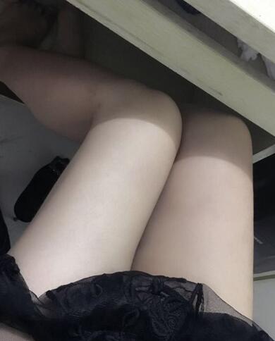 上海保加醫(yī)療美容門診部做大腿吸脂怎么樣？附楊勇醫(yī)生案例效果對(duì)比圖