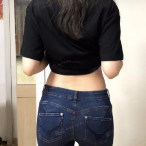 北京可思美整形醫(yī)院醫(yī)生斯勤做腰腹吸脂怎么樣？附案例效果對比圖