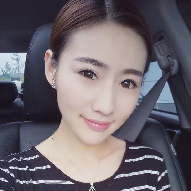 貴陽(yáng)美和諧醫(yī)療整形醫(yī)生孫澤芳做切開(kāi)雙眼皮效果怎么樣？附案例效果對(duì)比圖