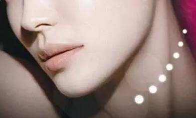 周口締萊美整形自體脂肪隆下巴