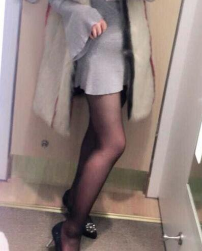 上海保加醫(yī)療美容門診部做大腿吸脂怎么樣？附楊勇醫(yī)生案例效果對比圖