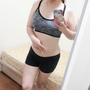 北京可思美整形醫(yī)院醫(yī)生斯勤做腰腹吸脂怎么樣？附案例效果對比圖