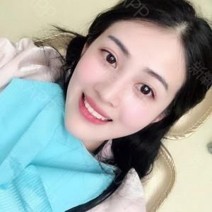 上?？仆呖谇会t(yī)院醫(yī)生鄧建儒做牙齒冷光美白怎么樣？附案例效果對(duì)比圖