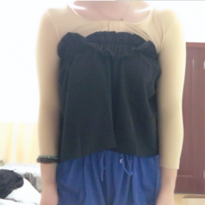 長沙柒和醫(yī)療整形醫(yī)生鐘滔做手臂吸脂怎么樣？附案例效果對(duì)比圖