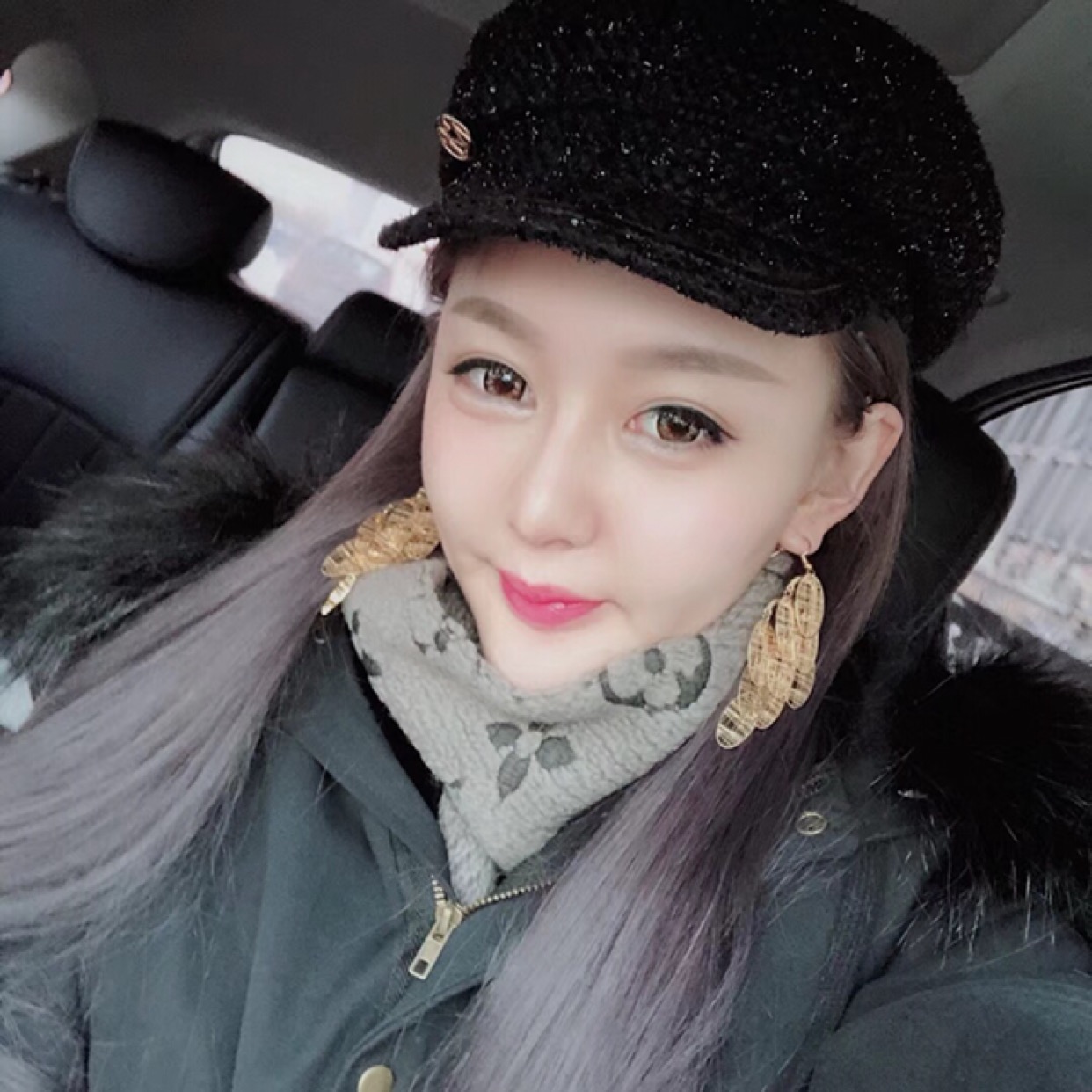 杭州格萊美整形美容醫(yī)院醫(yī)生張霞飛做自體脂肪全臉填充效果怎么樣？