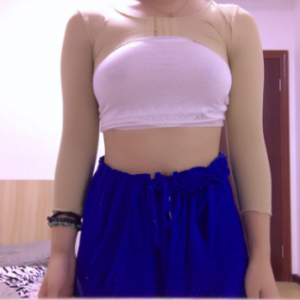 長沙柒和醫(yī)療整形醫(yī)生鐘滔做手臂吸脂怎么樣？附案例效果對(duì)比圖