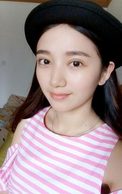 長治松禾醫(yī)療美容診所醫(yī)生馬俊峰做韓式微創(chuàng)定點雙眼皮效果怎么樣？附案例