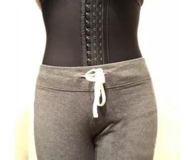 廣州尚美善造美容醫(yī)院醫(yī)生邵方做水動(dòng)力吸脂怎么樣？附案例效果圖