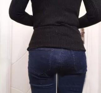 廣州尚美善造美容醫(yī)院醫(yī)生邵方做水動(dòng)力吸脂怎么樣？附案例效果圖