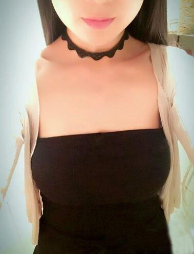 海南伊佳醫(yī)療美容醫(yī)院醫(yī)生涂陽(yáng)君做假體隆胸怎么樣？附案例效果對(duì)比圖