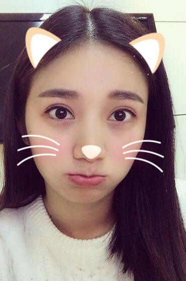 長治松禾醫(yī)療美容診所醫(yī)生馬俊峰做韓式微創(chuàng)定點(diǎn)雙眼皮效果怎么樣？附案例