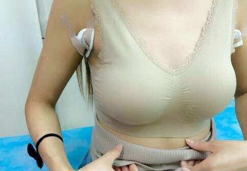 海南伊佳醫(yī)療美容醫(yī)院醫(yī)生涂陽(yáng)君做假體隆胸怎么樣？附案例效果對(duì)比圖