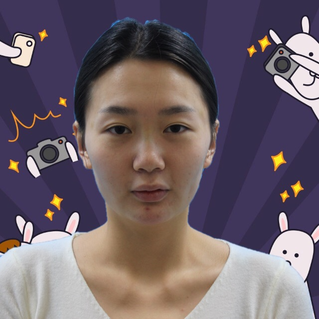 杭州格萊美整形美容醫(yī)院醫(yī)生張霞飛做自體脂肪全臉填充效果怎么樣？