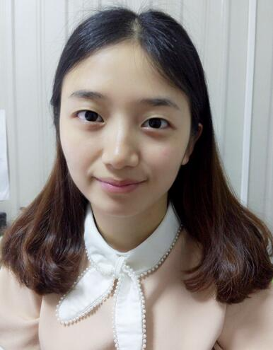 長治松禾醫(yī)療美容診所醫(yī)生馬俊峰做韓式微創(chuàng)定點(diǎn)雙眼皮效果怎么樣？附案例