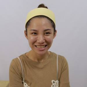 保定東陽(yáng)口腔醫(yī)院醫(yī)生白小青做牙齒冷光美白怎么樣？附案例效果對(duì)比圖