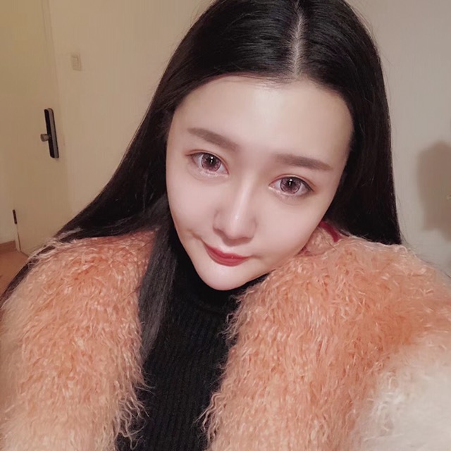 杭州格萊美整形美容醫(yī)院醫(yī)生張霞飛做自體脂肪全臉填充效果怎么樣？