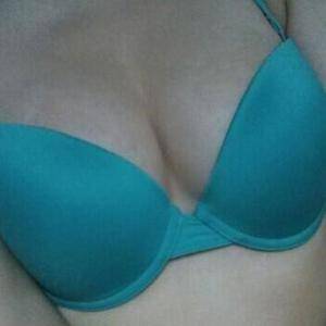 河南協(xié)和醫(yī)院整形外科醫(yī)生騰利做自體脂肪隆胸怎么樣？附案例效果對(duì)比圖