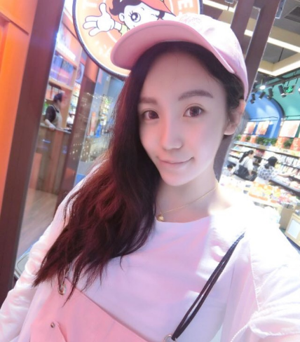 重慶當代整形美容醫(yī)院醫(yī)生楊健做假體隆胸怎么樣？附案例