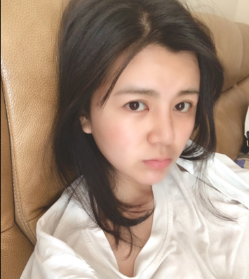 上海時光整形外科醫(yī)院醫(yī)生何晉龍做假體隆胸怎么樣？附案例效果對比圖