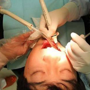 淄博口腔醫(yī)院醫(yī)生牟象鑫做超聲波洗牙怎么樣？附案例效果對比圖