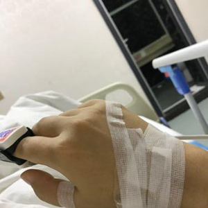 河南協(xié)和醫(yī)院整形外科醫(yī)生騰利做自體脂肪隆胸怎么樣？附案例效果對(duì)比圖