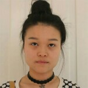 鄭州管城中醫(yī)院整形美容中心醫(yī)生張秀英做注射瘦臉怎么樣？附除皺瘦臉案例效果圖