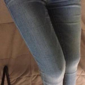 貴陽(yáng)華美整形美容醫(yī)院醫(yī)生田永華做大腿吸脂效果怎么樣？附大腿吸脂案例前后對(duì)比圖