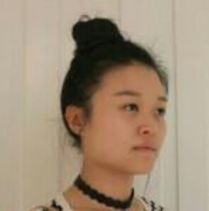 鄭州管城中醫(yī)院整形美容中心醫(yī)生張秀英做注射瘦臉怎么樣？附除皺瘦臉案例效果圖