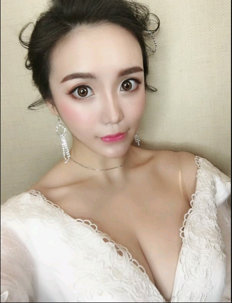 重慶當代整形美容醫(yī)院醫(yī)生楊健做假體隆胸怎么樣？附案例